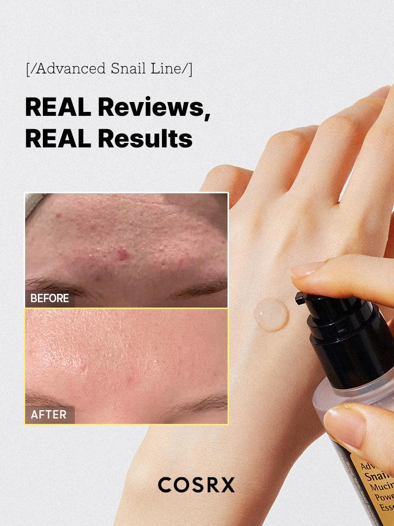 CosRx Advanced Snail 96 Mucin Power Essence