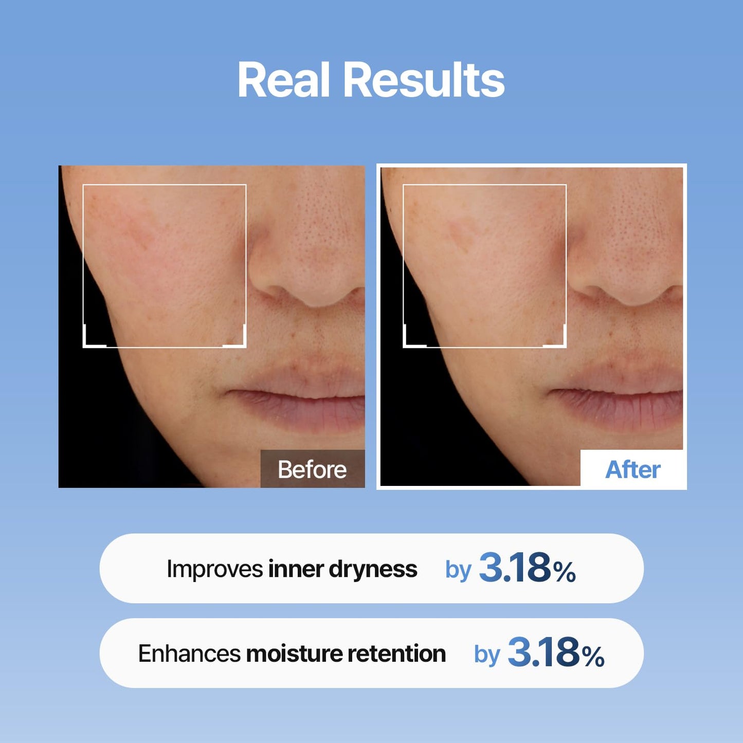 Meditherapy Hyaluronic Acid Skin Booster First Serum