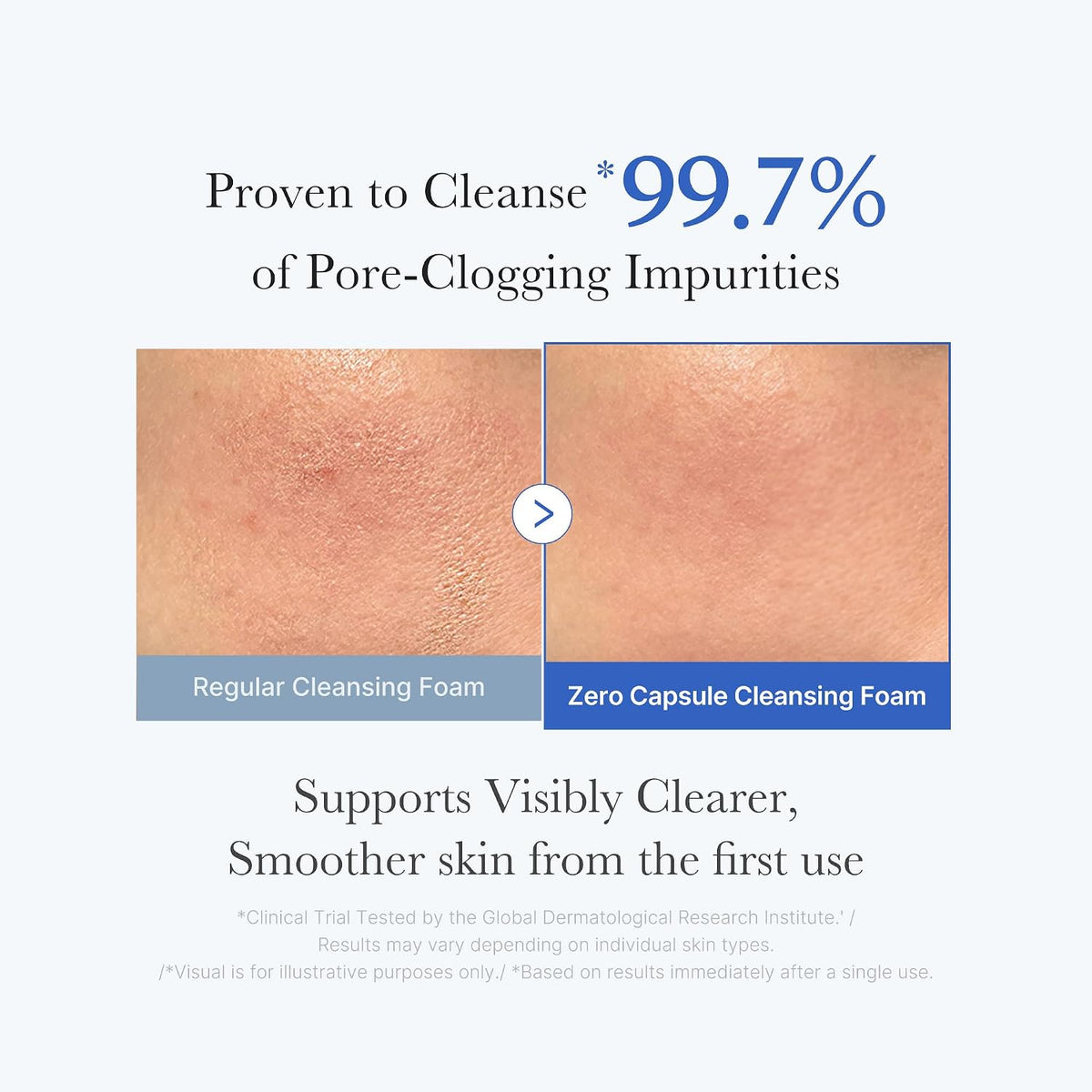 Medicube Zero Pore SA Clear Capsule Cleansing Foam
